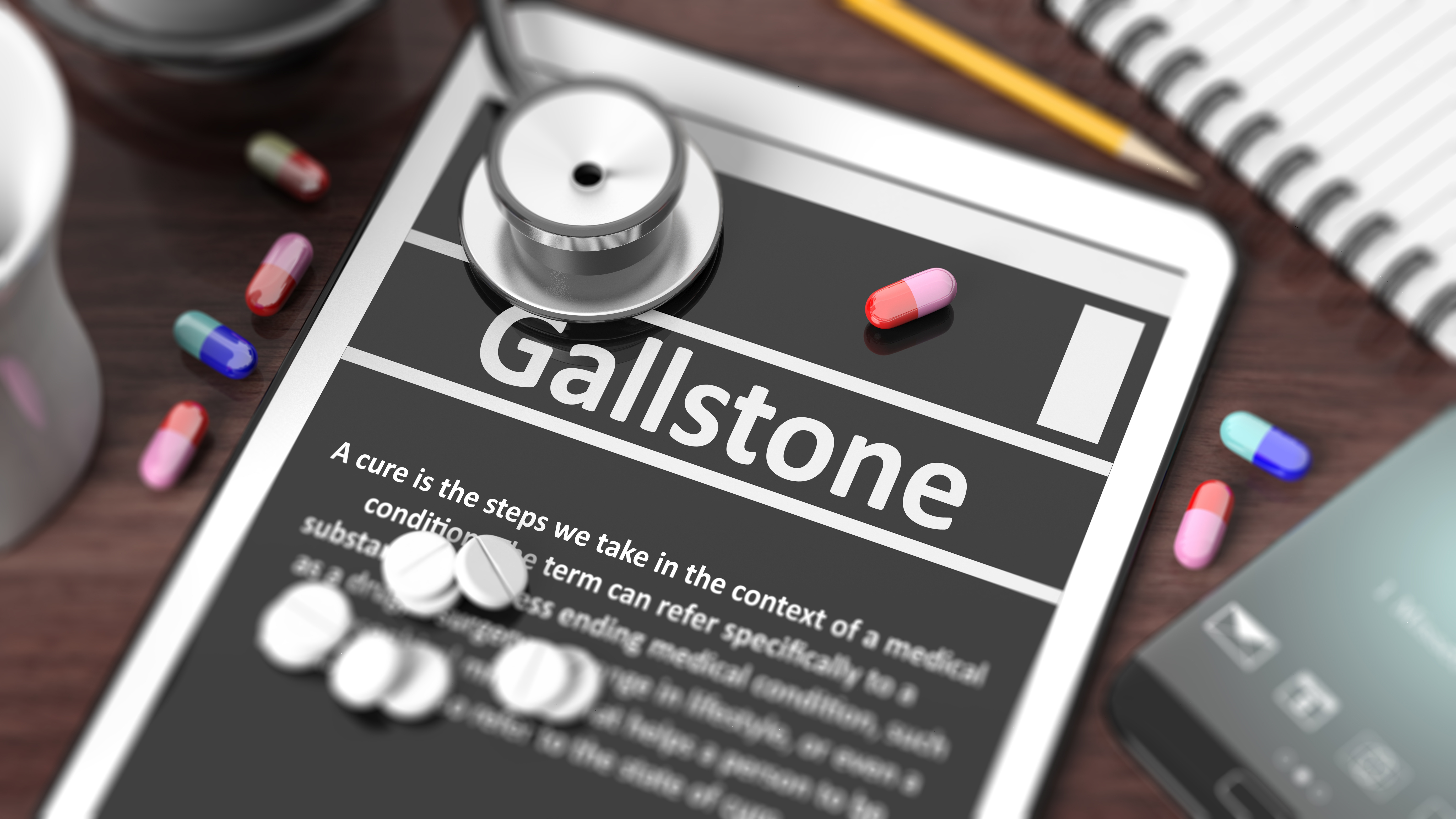 Gallstones