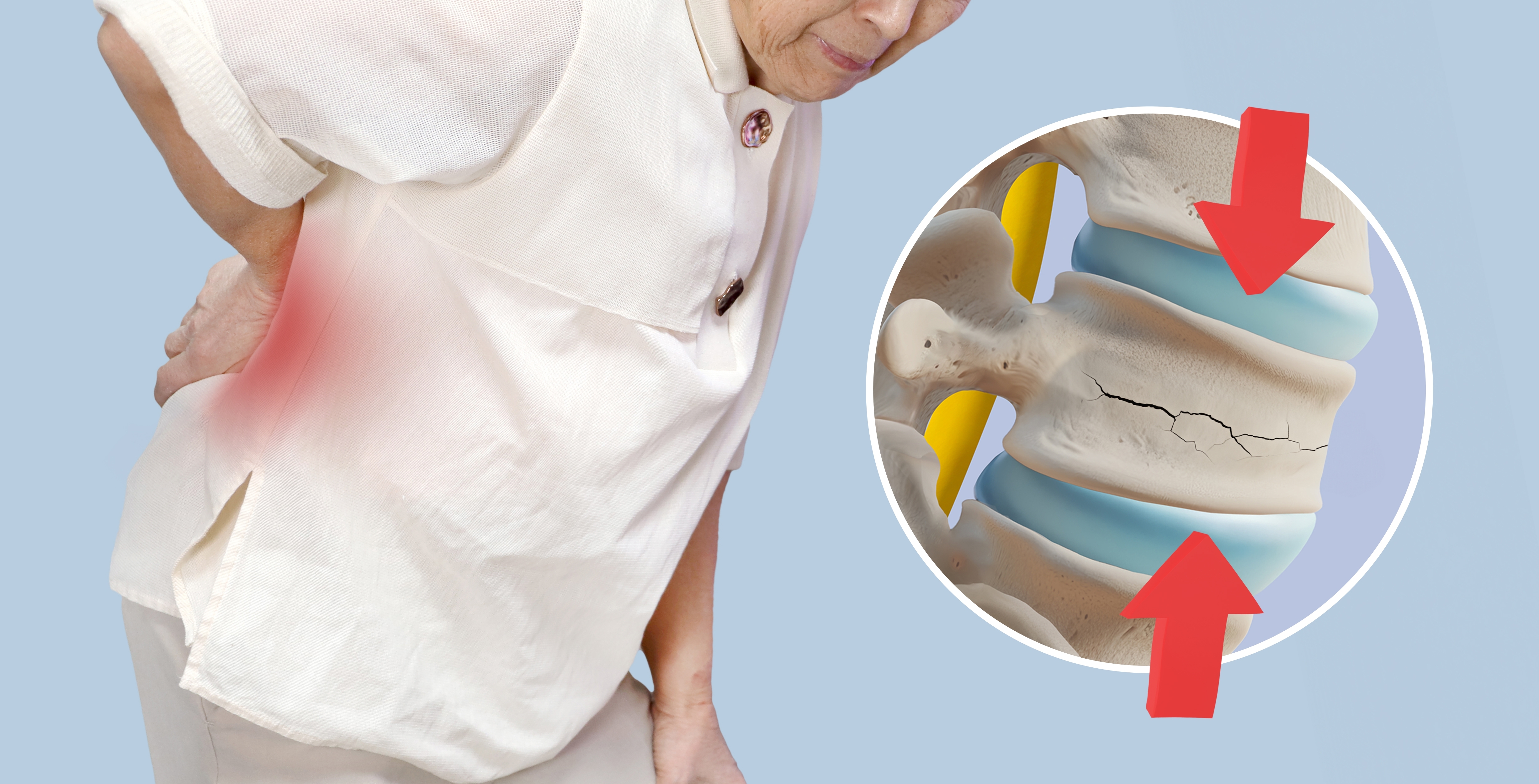 Stress Fracture: Symptoms, Causes, Diagnosis & Treatment