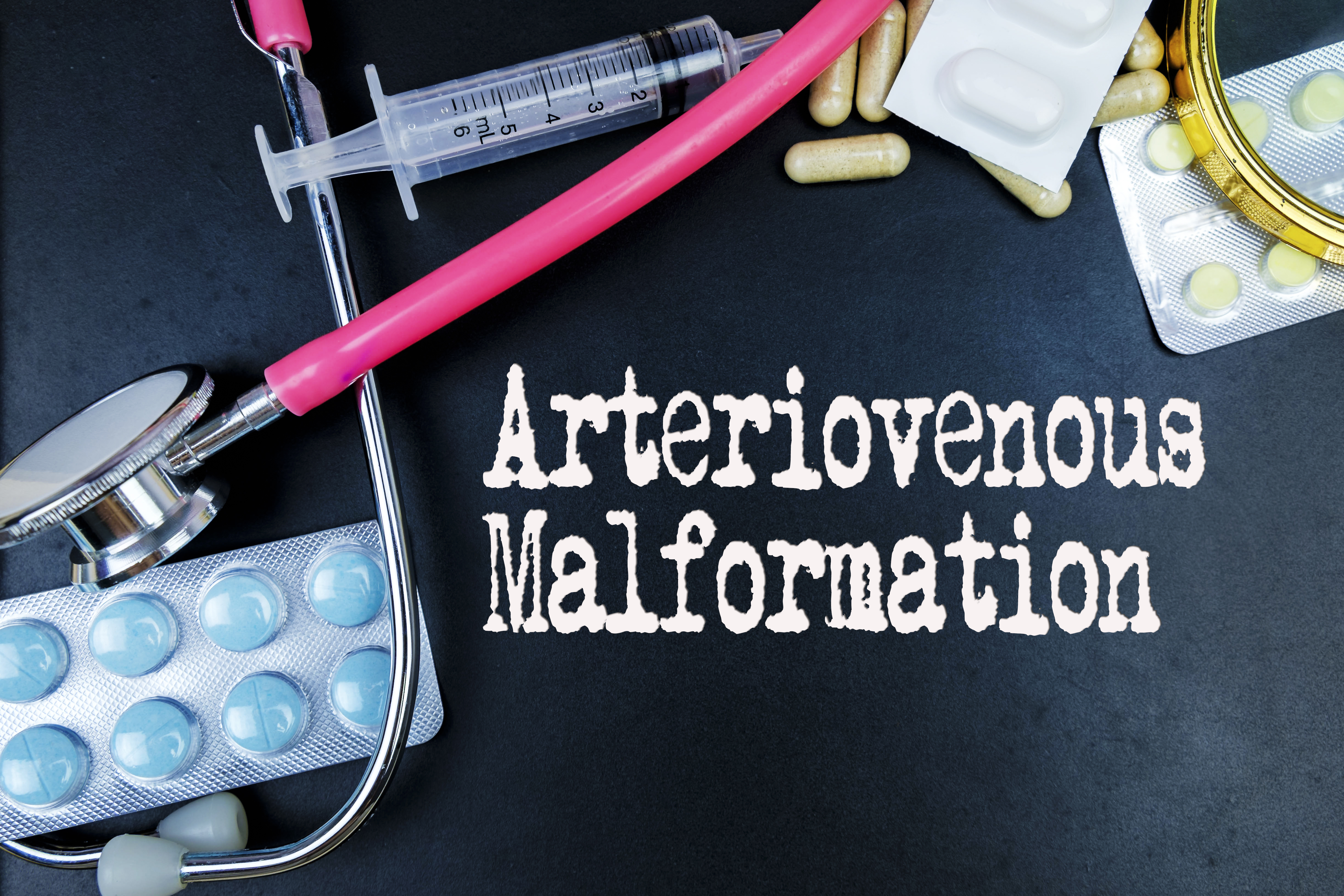 Arteriovenous Malformation