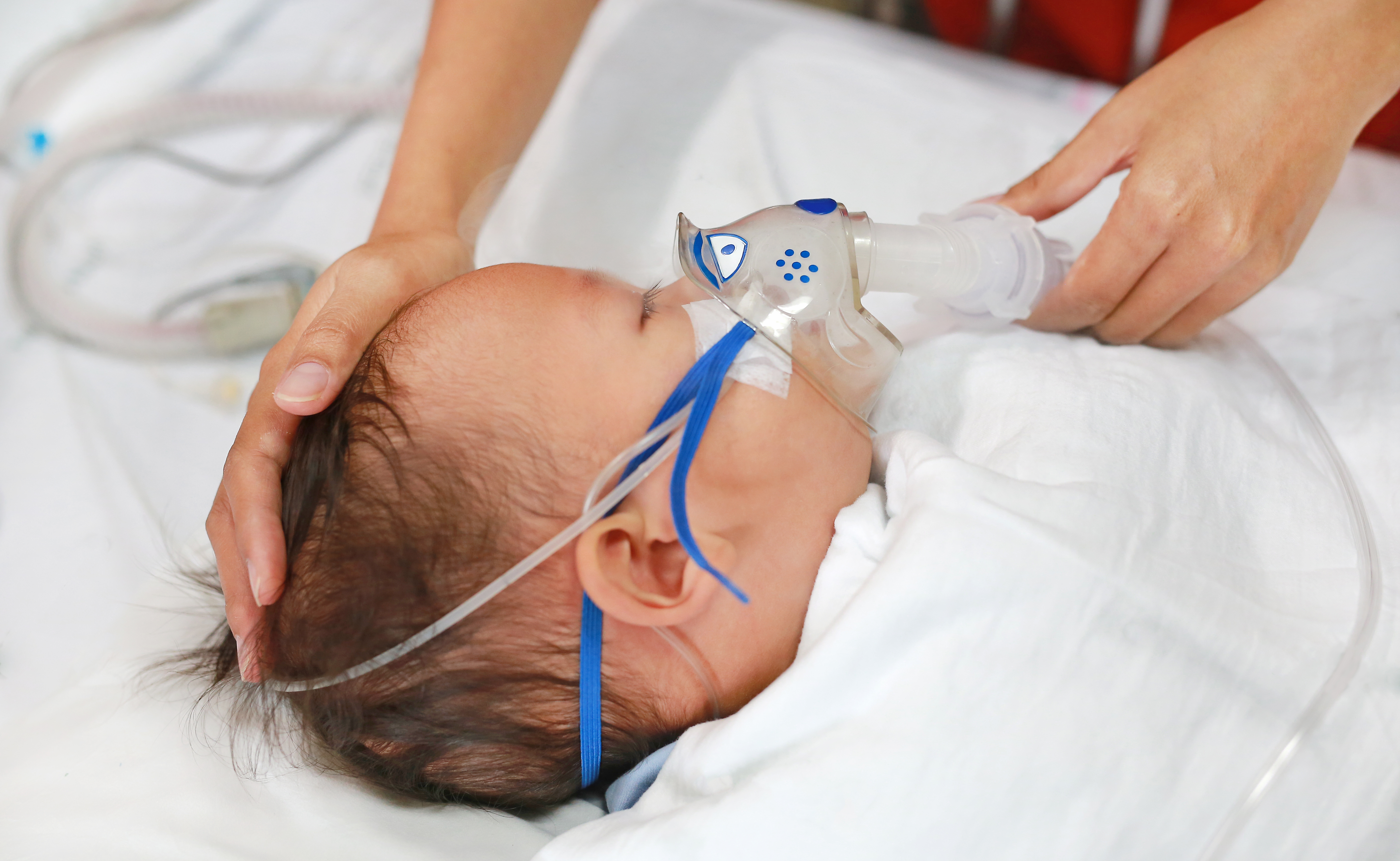 Pulmonary Hypertension in Newborns