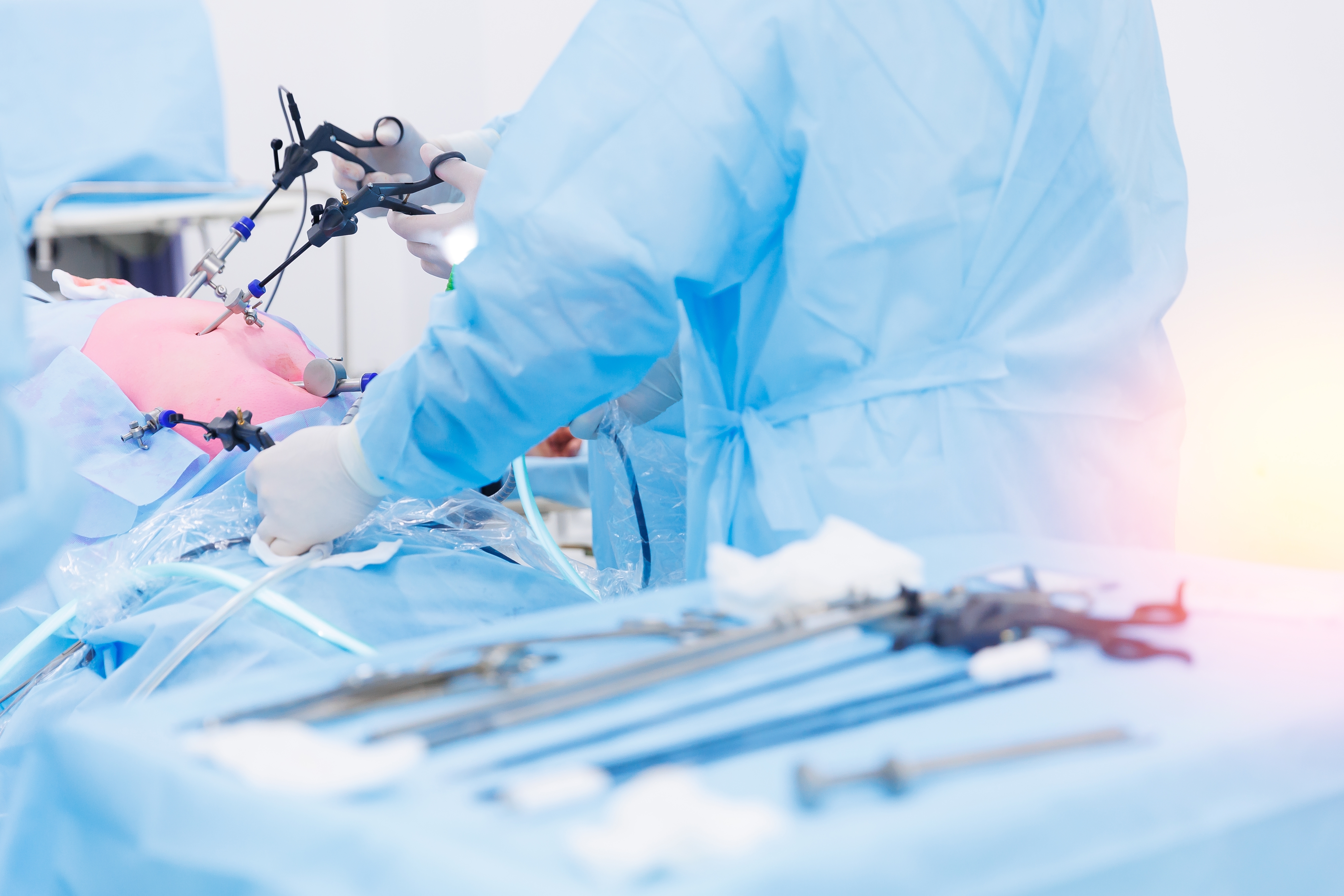 Laparoscopic Surgery in Children