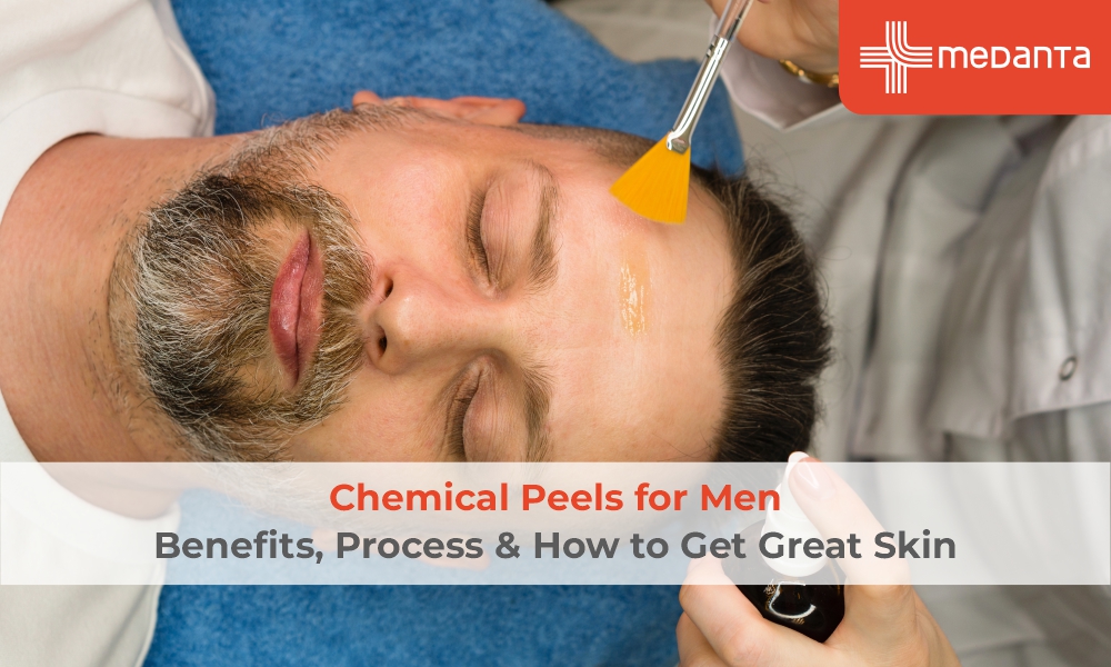 Chemical Peels for Men's Skin