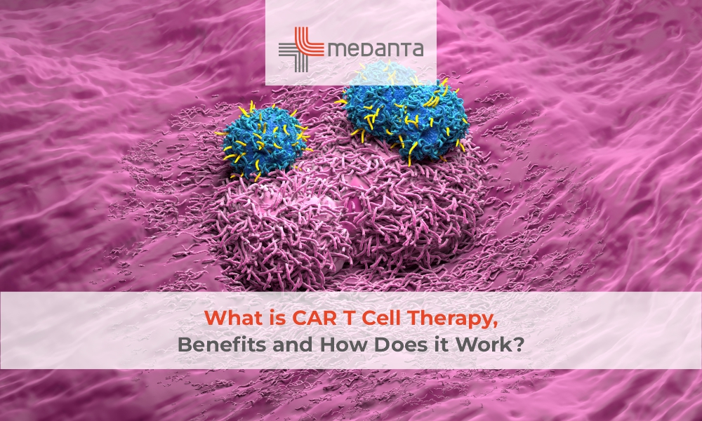 What is CAR T Cell Therapy, Benefits and How Does it Work?