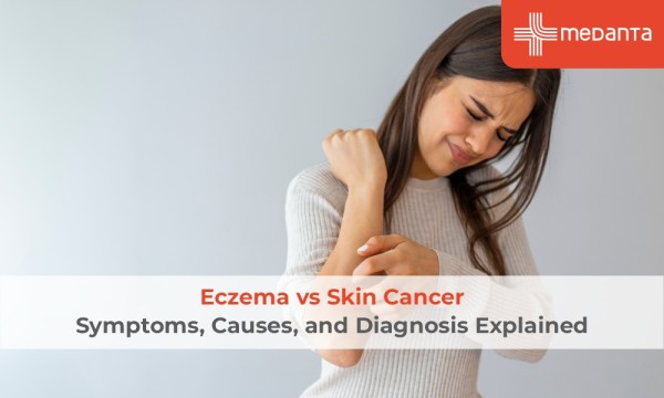 Eczema vs. Skin Cancer: Symptoms, Causes, and Diagnosis Explained