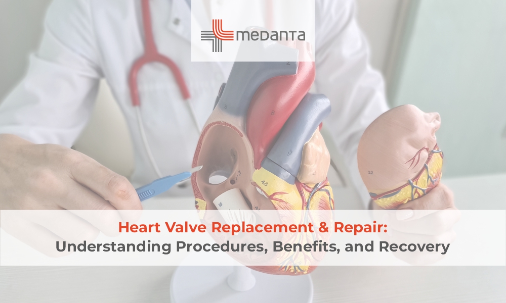 Heart Valve Replacement & Repair