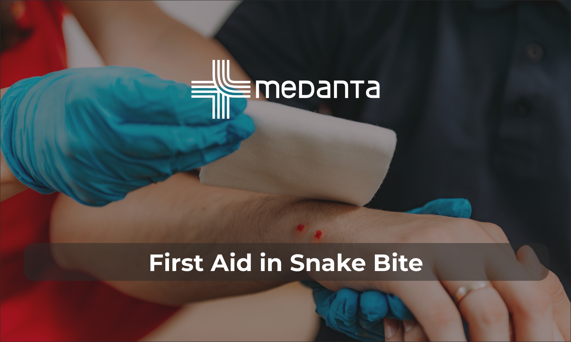 First Aid for Snake Bites