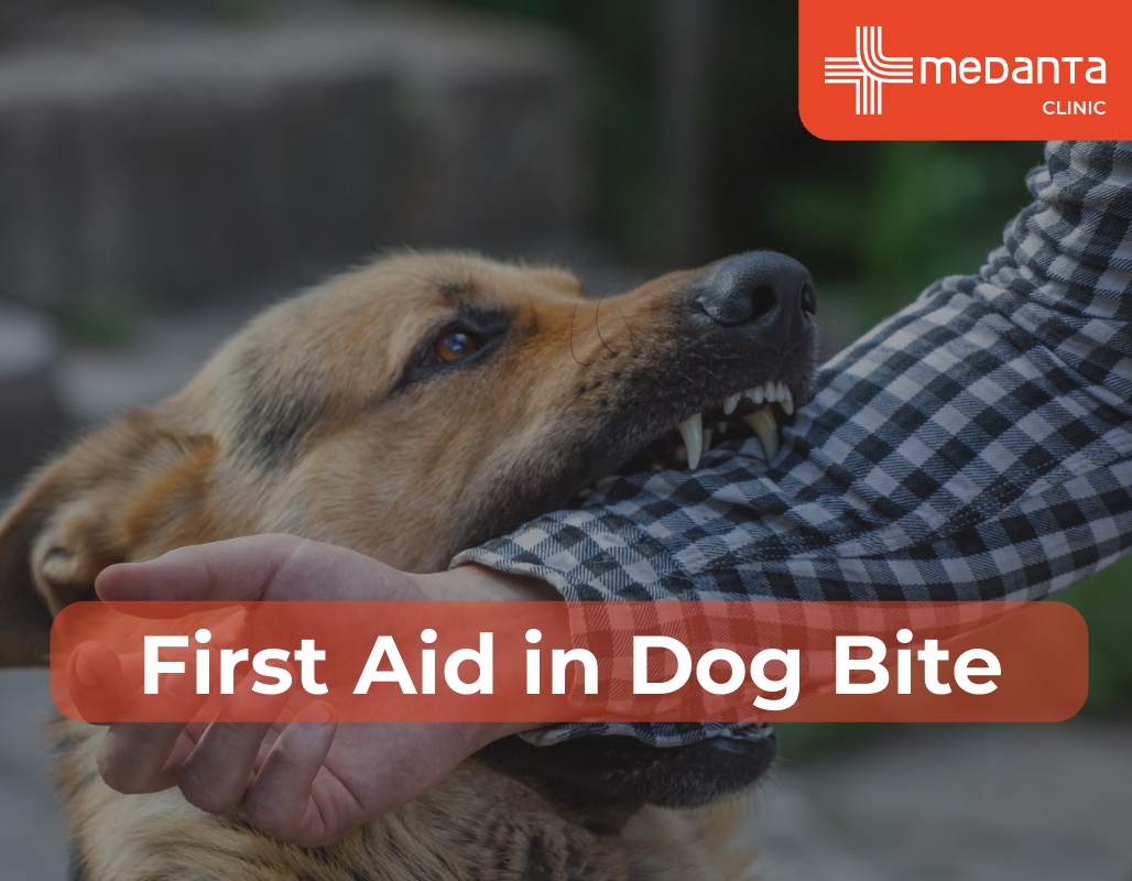 First Aid for Dog Bites