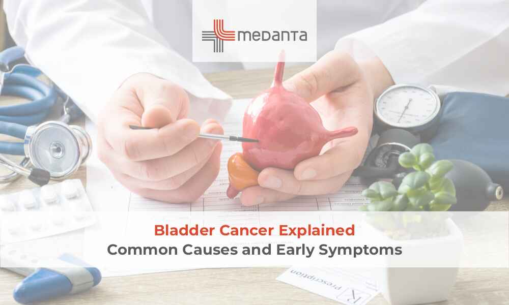 Bladder Cancer