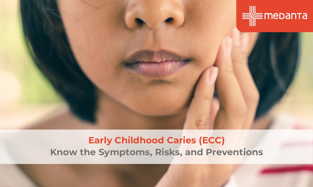 Early Childhood Caries (ECC)