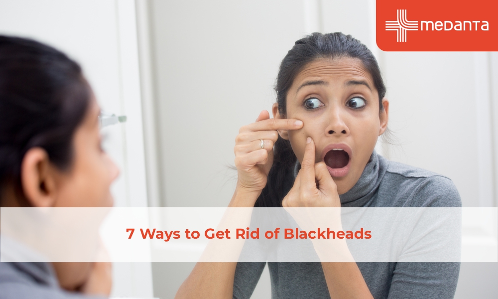 Get Rid of Blackheads