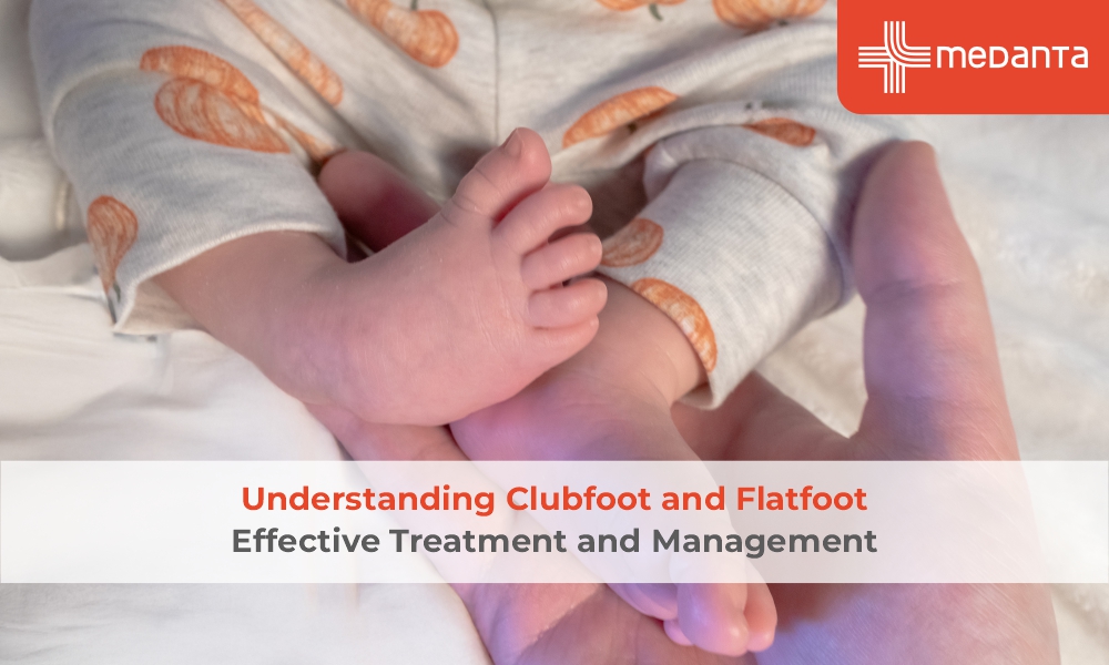 Understanding Clubfoot and Flatfoot