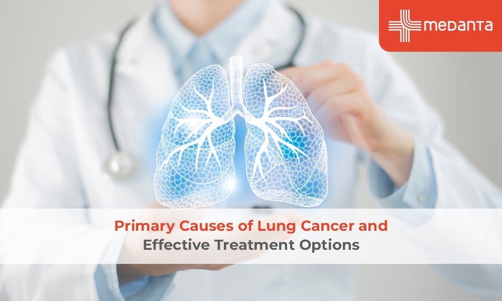 Primary Causes of Lung Cancer and Effective Treatment Options