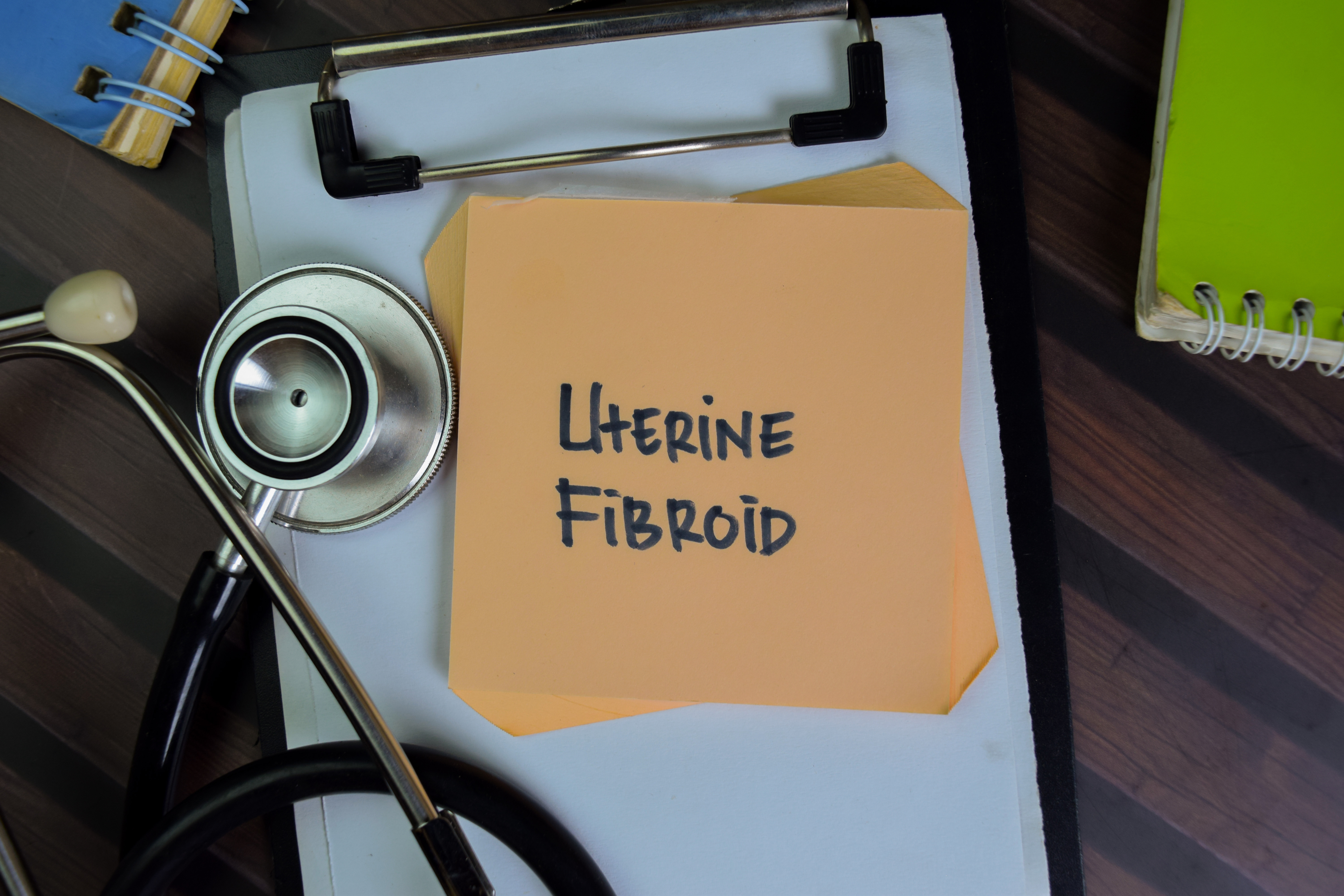 Uterine Fibroid Relief