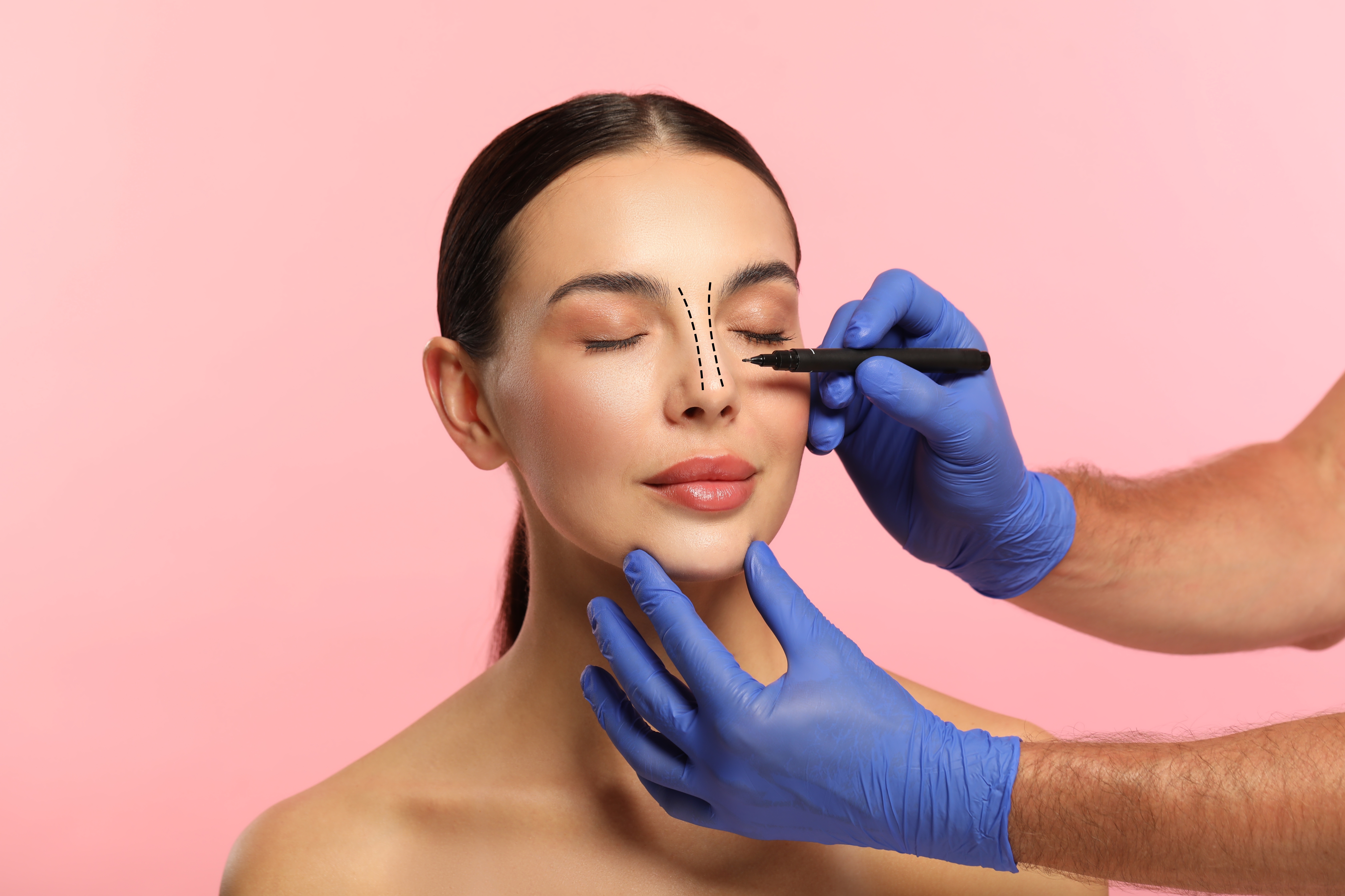 Different Rhinoplasty Techniques: Choosing the Approach That Fits Your Goals