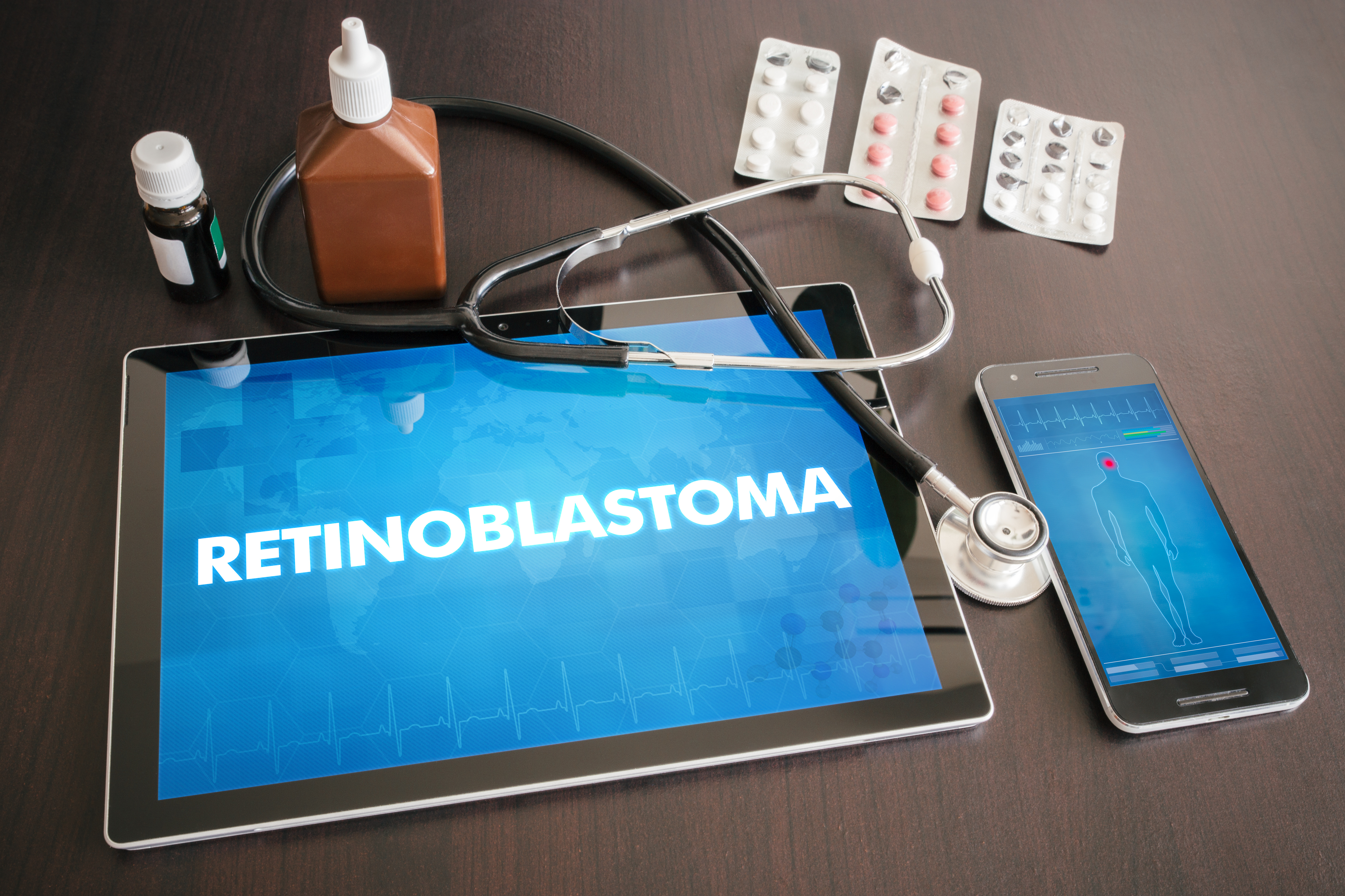 Retinoblastoma