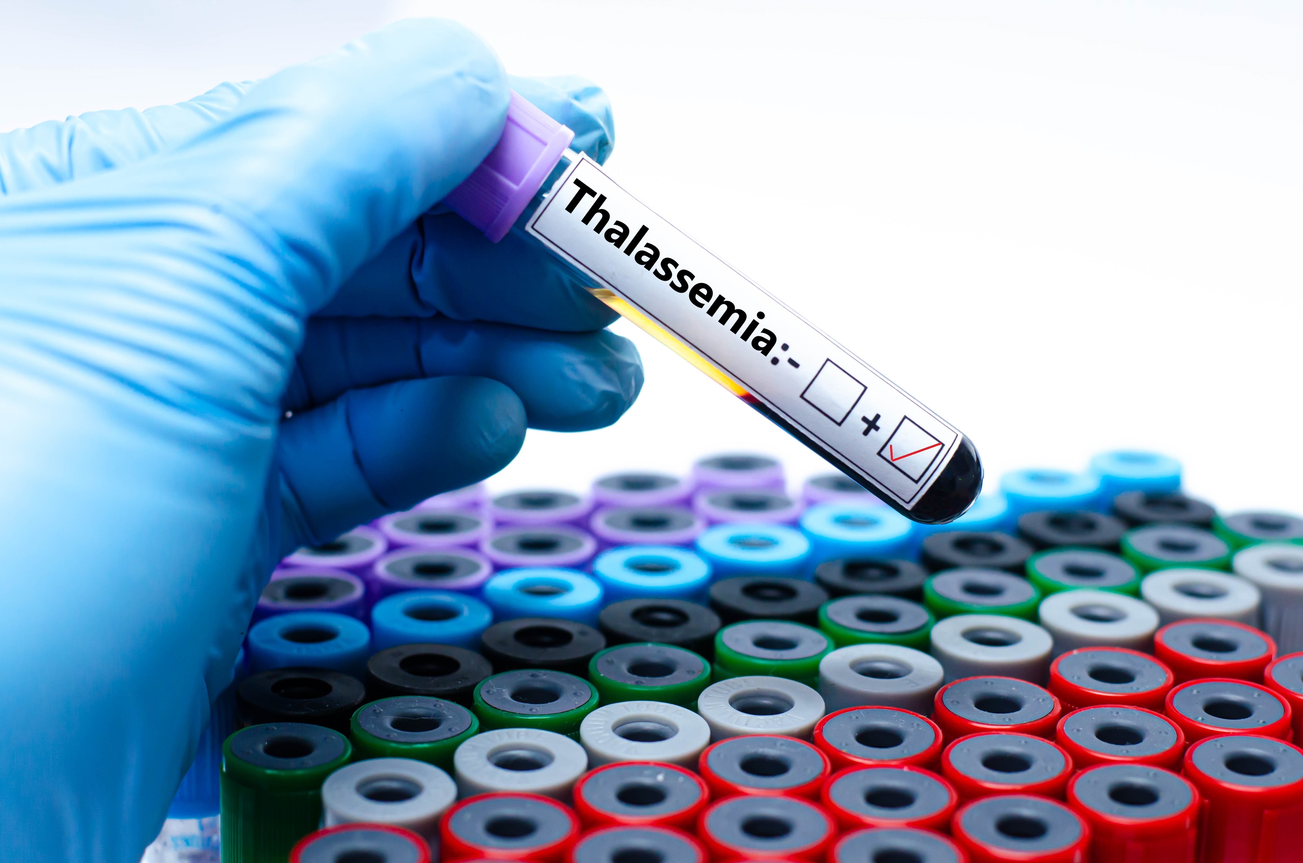 Thalassemia