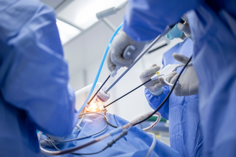 Minimal Invasive Cardiac Surgery