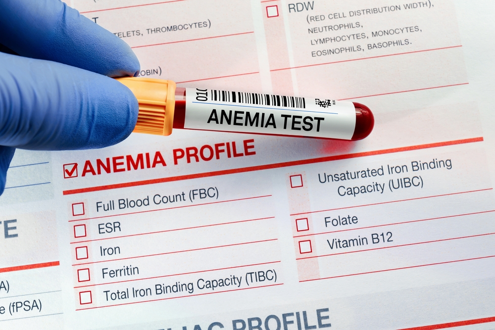 Aplastic Anaemia 