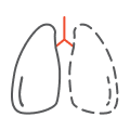 Lung Transplant