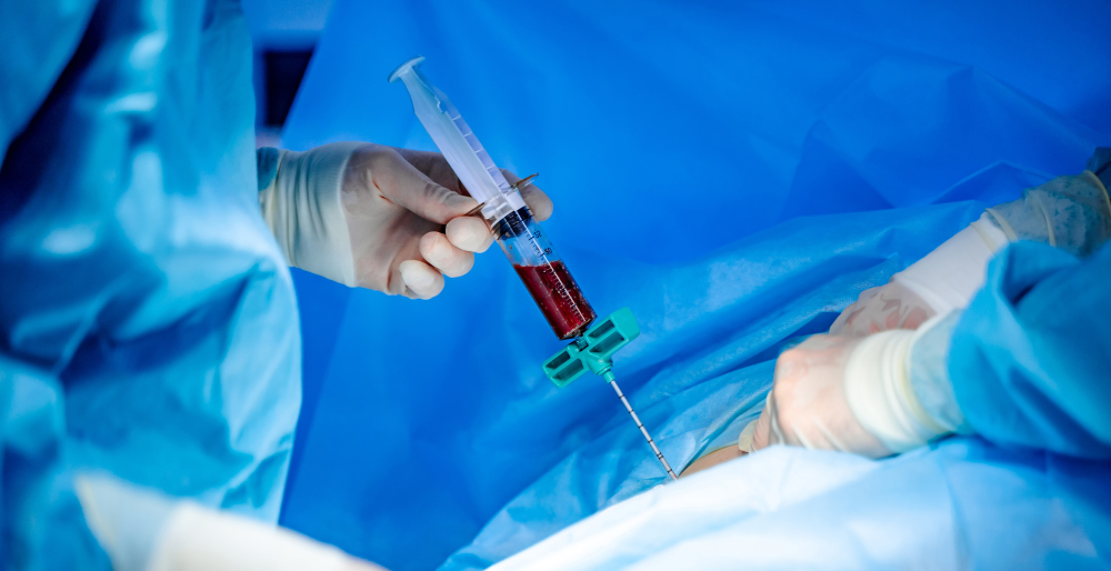 Bone Marrow Aspiration and Biopsy